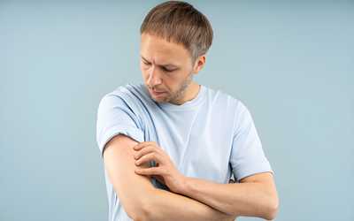 What Heals Eczema the Fastest? Complete Guide