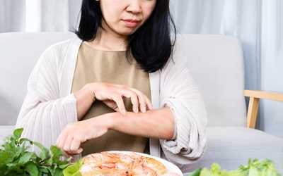 What is the First Step in Treatment of Food Allergies?